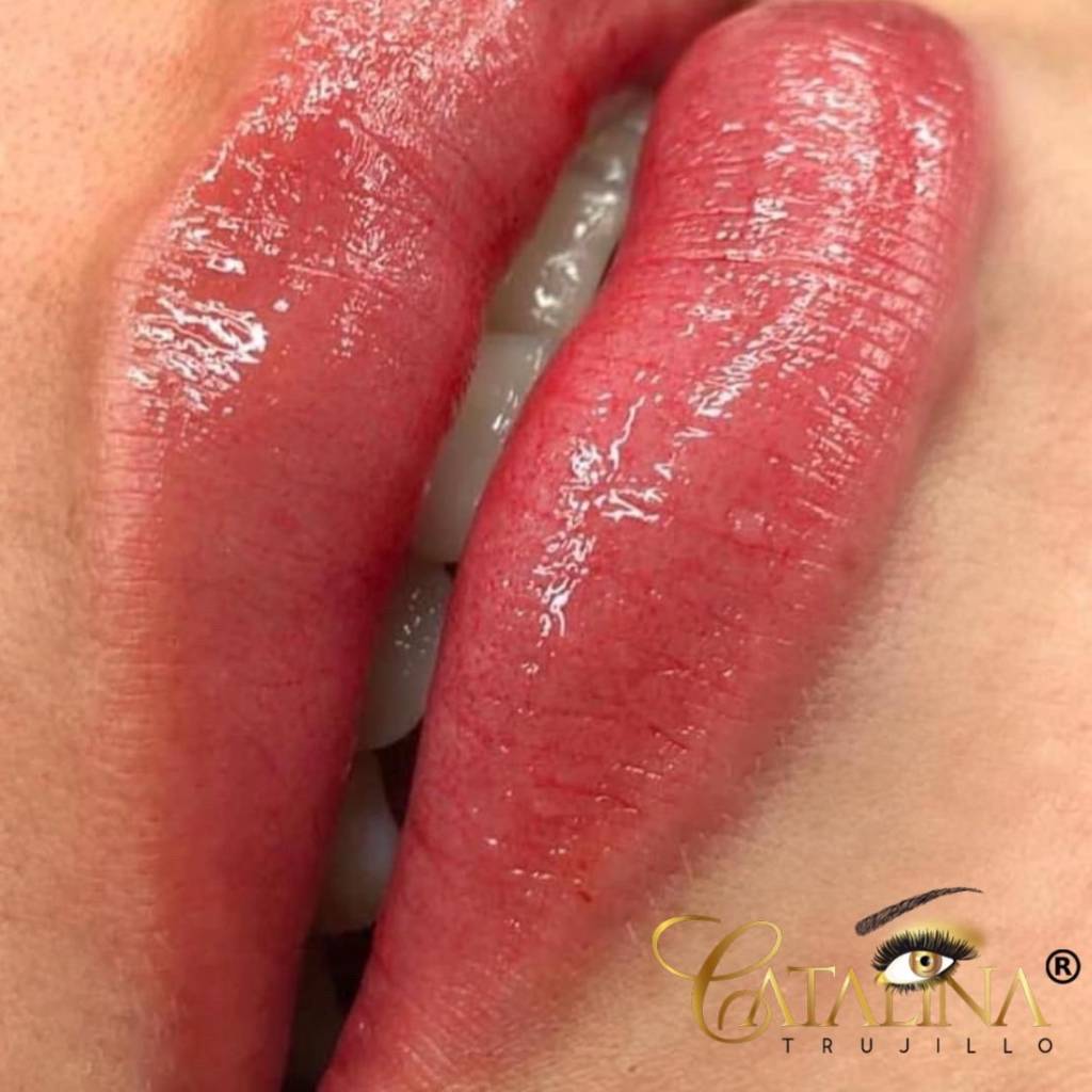 Revitalizacion de labios